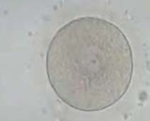 ?tapes de maturation d'Oocyte